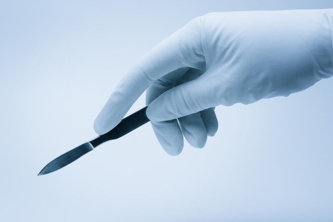 pisau bedah untuk operasi pembesaran penis